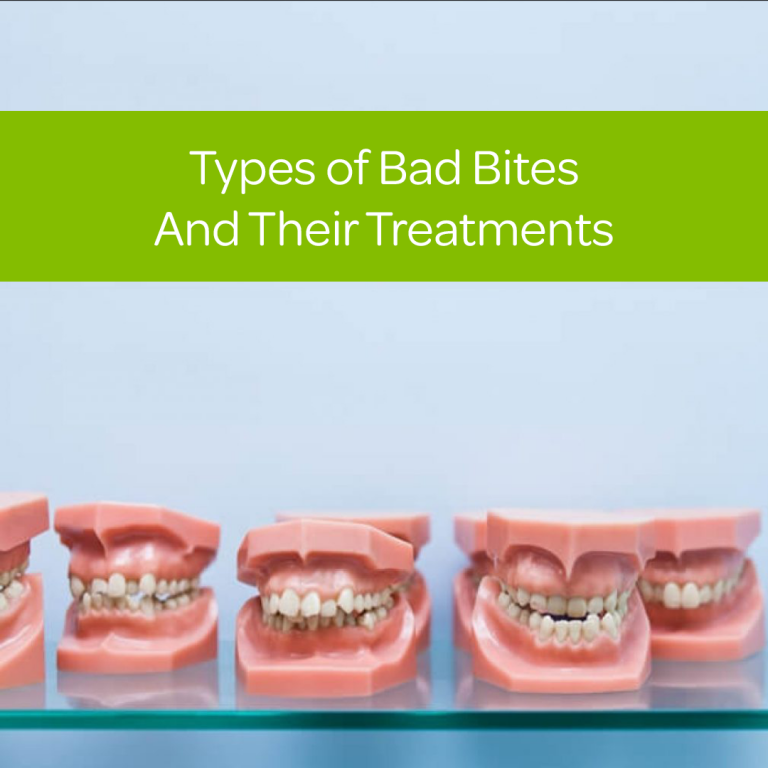 Types of Bad Bites and Their Treatments InStyle Dental